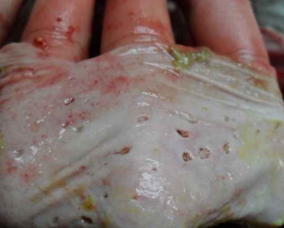 養豬要嚴防豬胃潰瘍發生